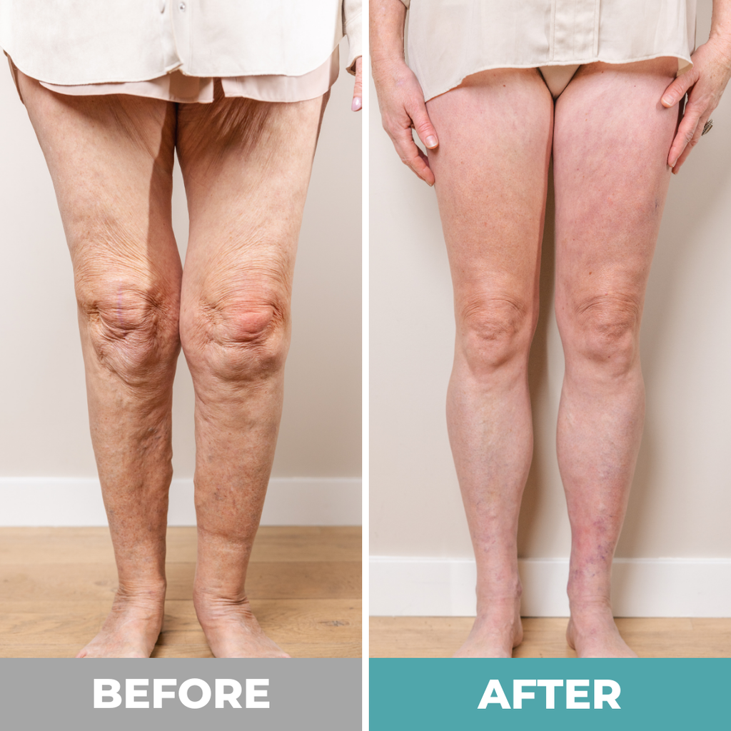 ReliveX™ Foot massager