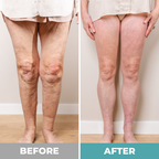 ReliveX™ Foot massager